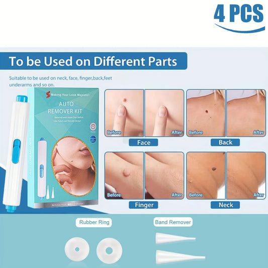 1/2/4 Pcs Removal Kit for Skin Care, One Hand User Friendly Design, Safe and Effective for Home Use
