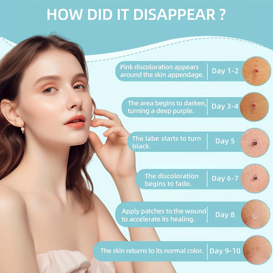 1/2/4 Pcs Removal Kit for Skin Care, One Hand User Friendly Design, Safe and Effective for Home Use